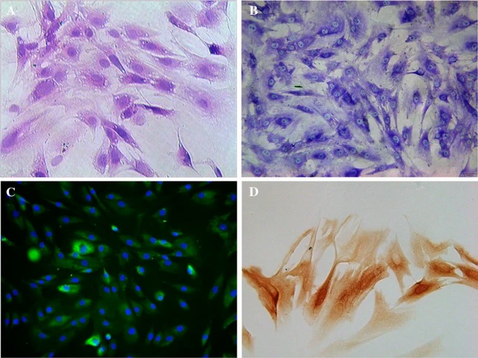 Staining evaluation of nucleus pulposus cells (NPCs): (a) Hematoxylin and eosin (H&E) staining; (b) Toluidine blue staining; (c) Immunofluorescence staining; (d) Immunohistochemical staining.