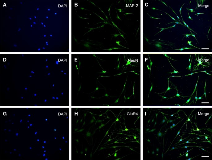 Expression of characteristic proteins NeuN, MAP-2 and GluR4 in cells.
