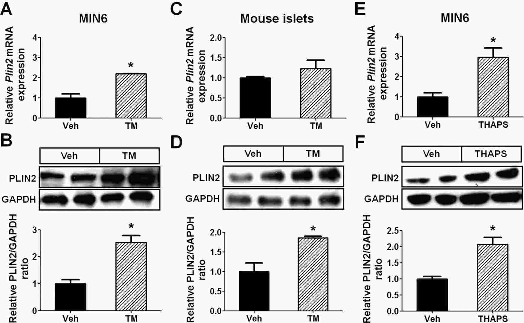 PLIN2 expression were upregulated by ER stress in MIN6 cells and mouse pancreatic islets.