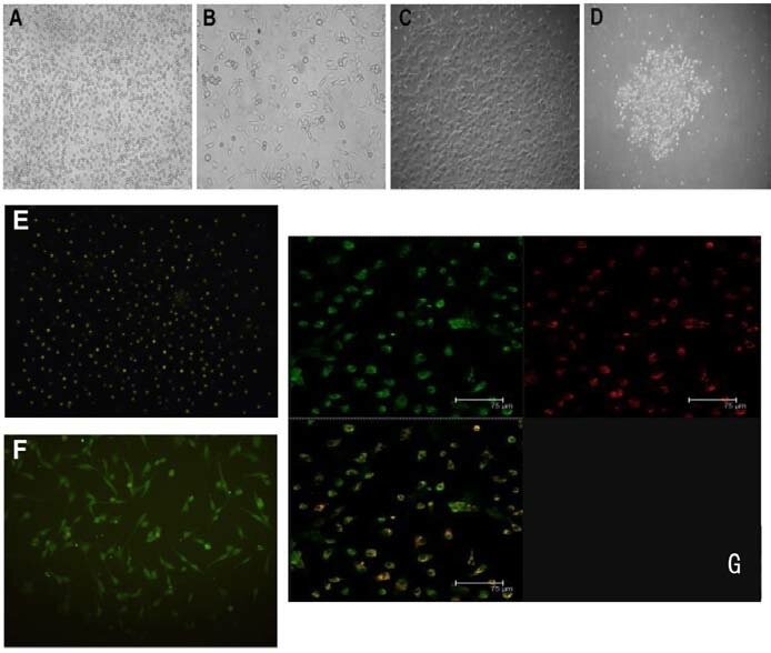 Rat bone marrow-derived EPCs culture, expansion and identification.