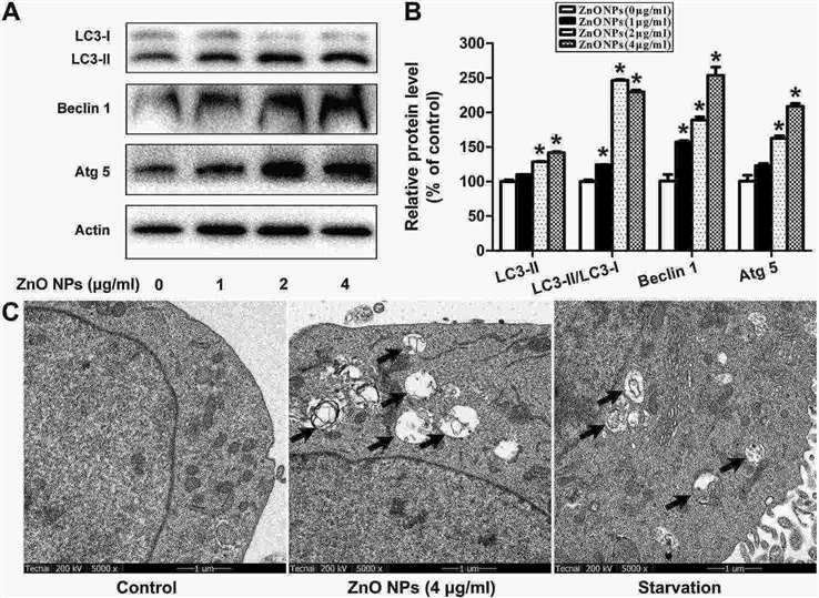 ZnO NPs induce autophagy in mouse GC-1 spg cells.