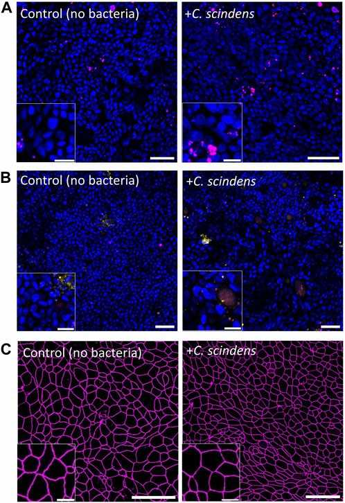 Co-culture of C. scindens with primary human colonic epithelial cells.