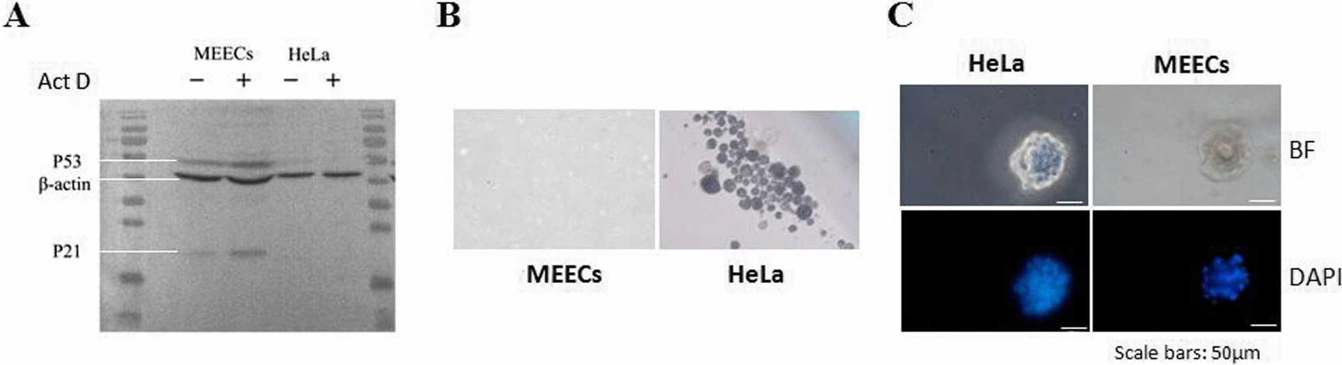 Characterization of normal biological features of MEECs.