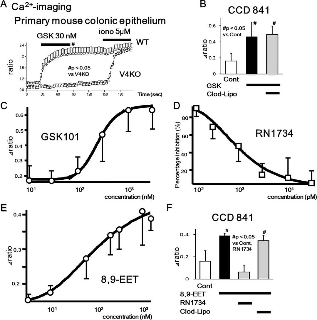 TRPV4 facilitates an elevation of cytosolic Ca2+ concentration ([Ca2+]i) in both mouse primary colonic epithelial cells and CCD 841 cells.