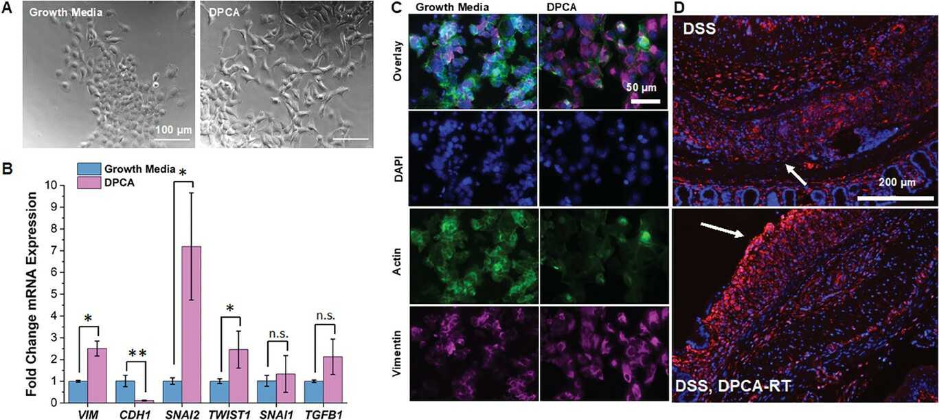 DPCA facilitates colon lining repair by activating epithelial cells.