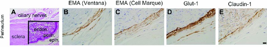 Characterization of perineurial cell markers.