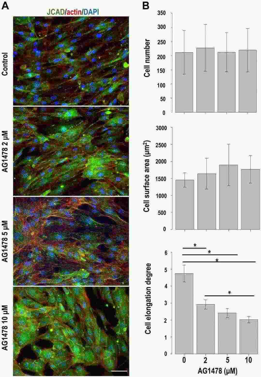 Impact of EGFR inhibition on cultured human perineurial cells.