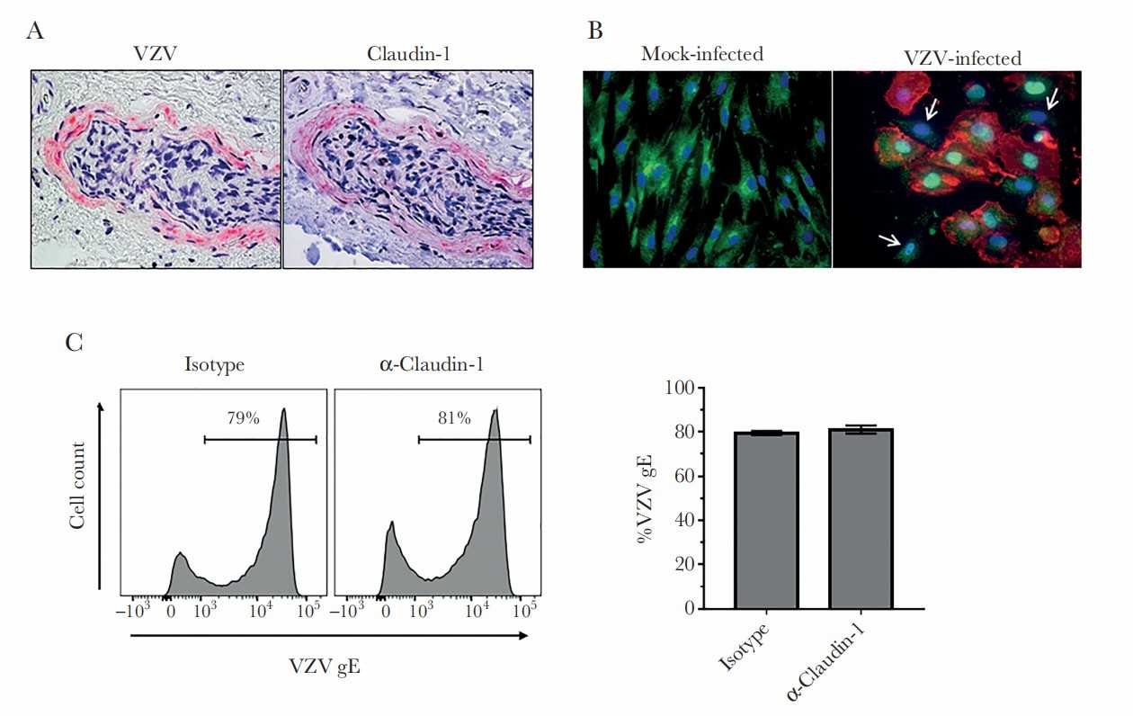 Varicella zoster virus (VZV) infection in perineurial cells expressing claudin-1.