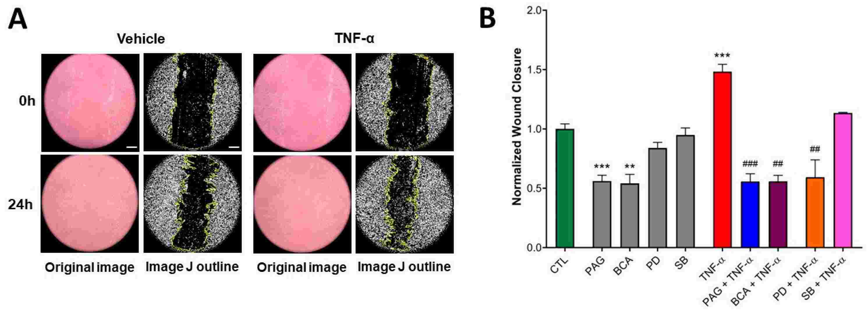 CSE activity is indispensable for basal and TNF-α-mediated human colonic epithelial cells wound healing.