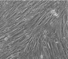 Morphological of telomerase-immortalised endometrial stromal cell line.