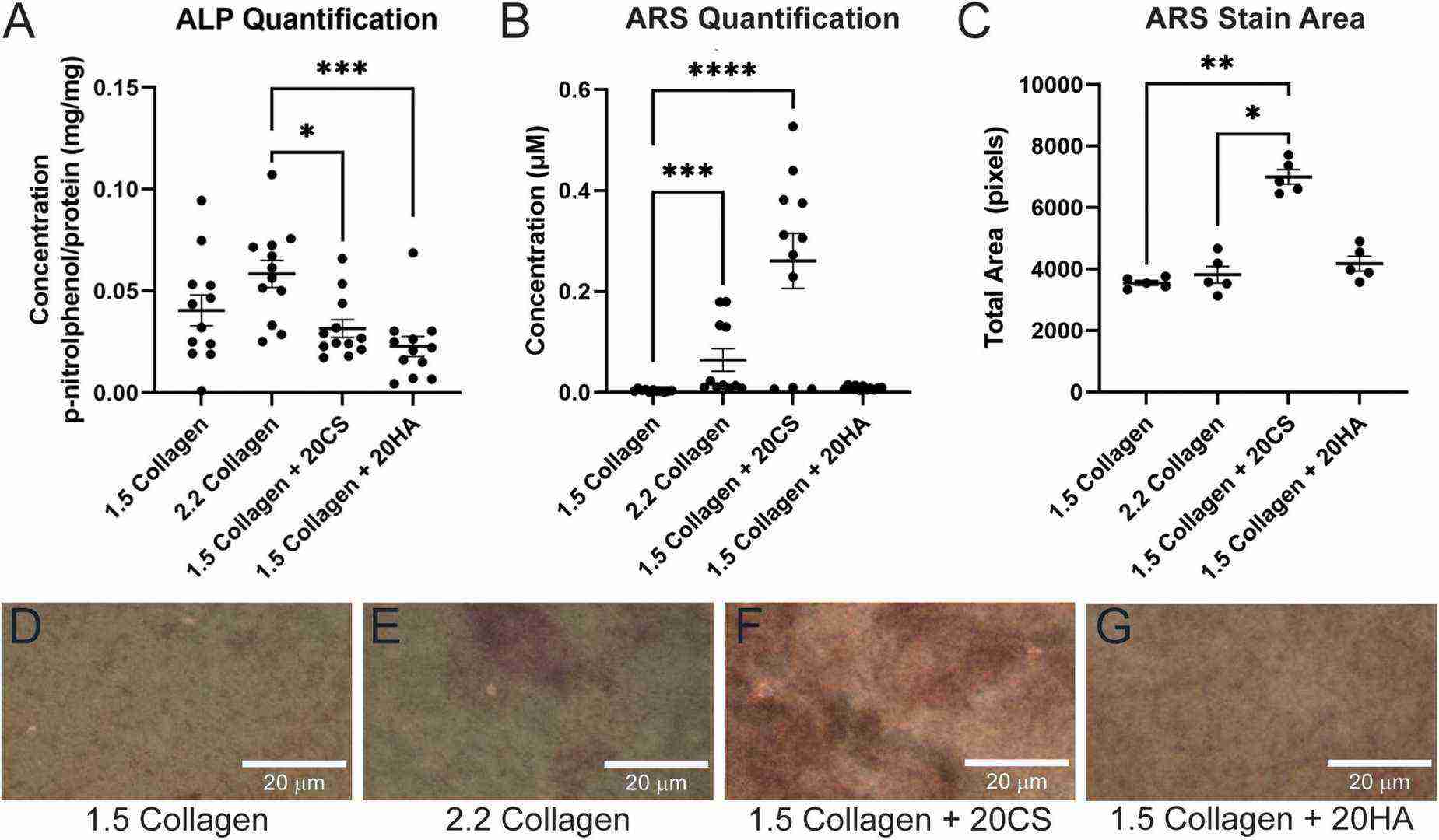 Chondroitin sulfate promotes calcific nodule formation, whereas glycosaminoglycans (GAGs) do not increase alkaline phosphatase (ALP) activity.