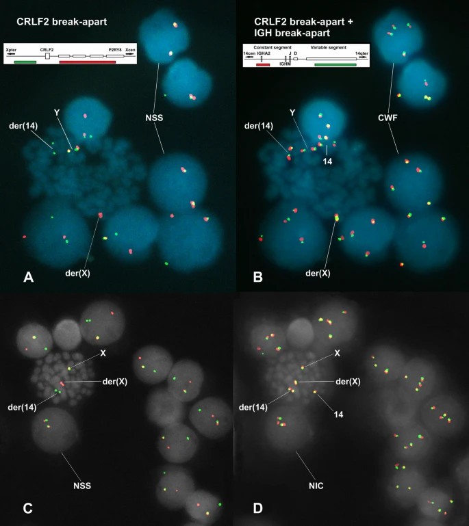 A and C present FISH performed with the CRLF2-BA probe, and B and D show FISH performed by mixing both the CRLF2-BA and IGH-BA probes.