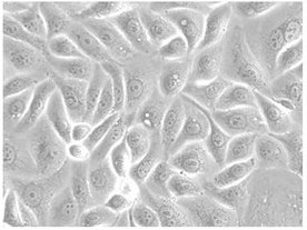 Transmission electron microscopy analysis of KYSE140 cells.