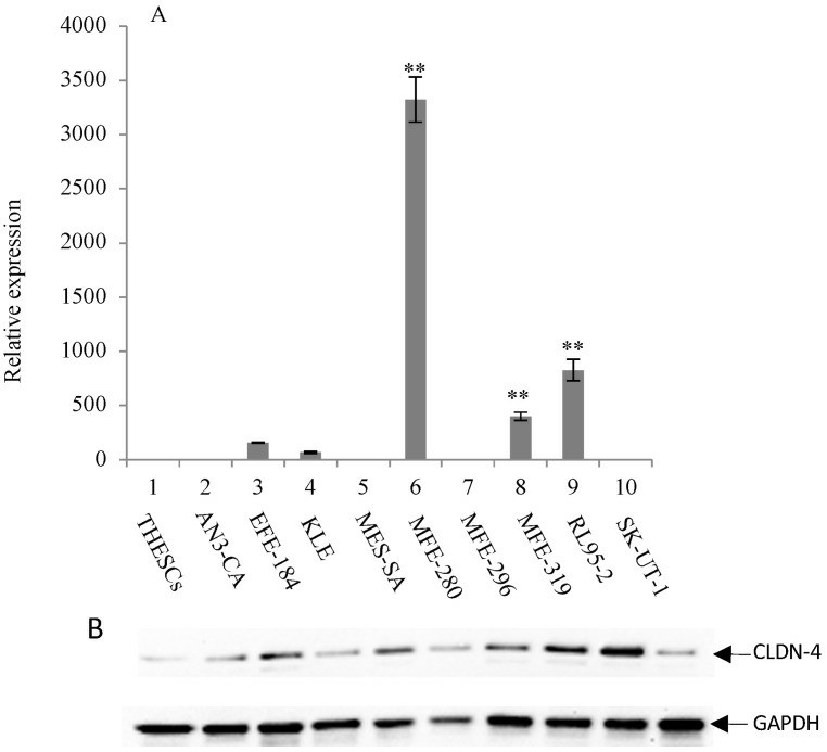 CLDN-3 overexpression in various endometrial cancer cell lines.