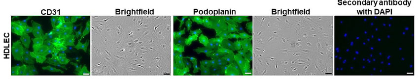 Human dermal lymphatic endothelial cells stained with DAPI (blue nuclei) and immuno-stained with CD31.