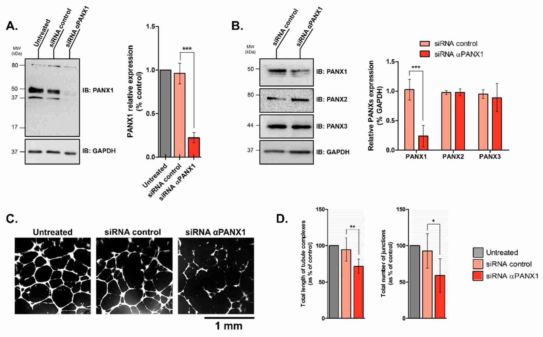 Reduction of Pannexin-1 expression impairs capillary-like formation by HDLECs.