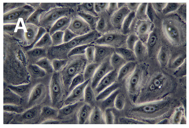 Photomicrographs of human oral keratinocytes.