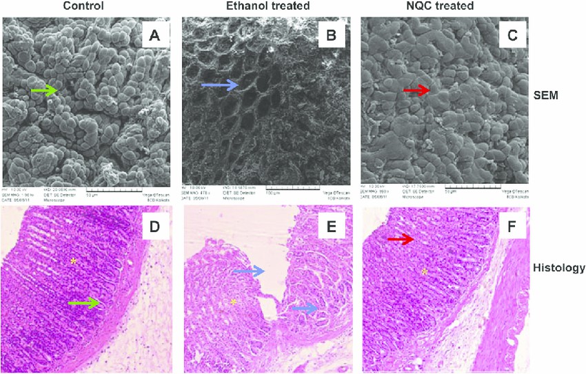 Scanning electron microscopy (SEM) coupled with histological analysis to study rat gastric mucosa.
