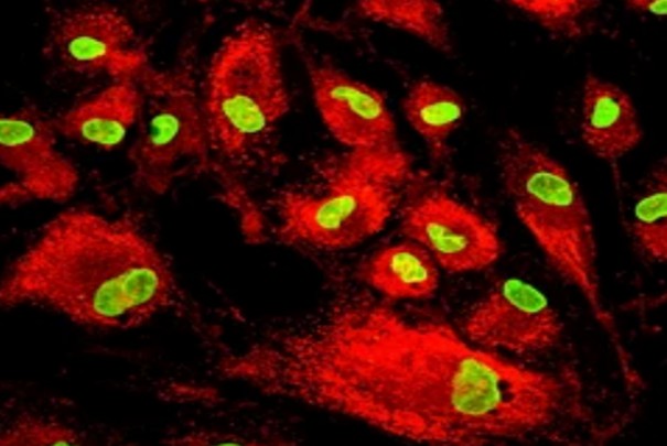 overview-of-common-tracking-labels-for-mscs