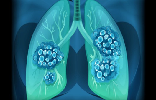 Respiratory Disease Models