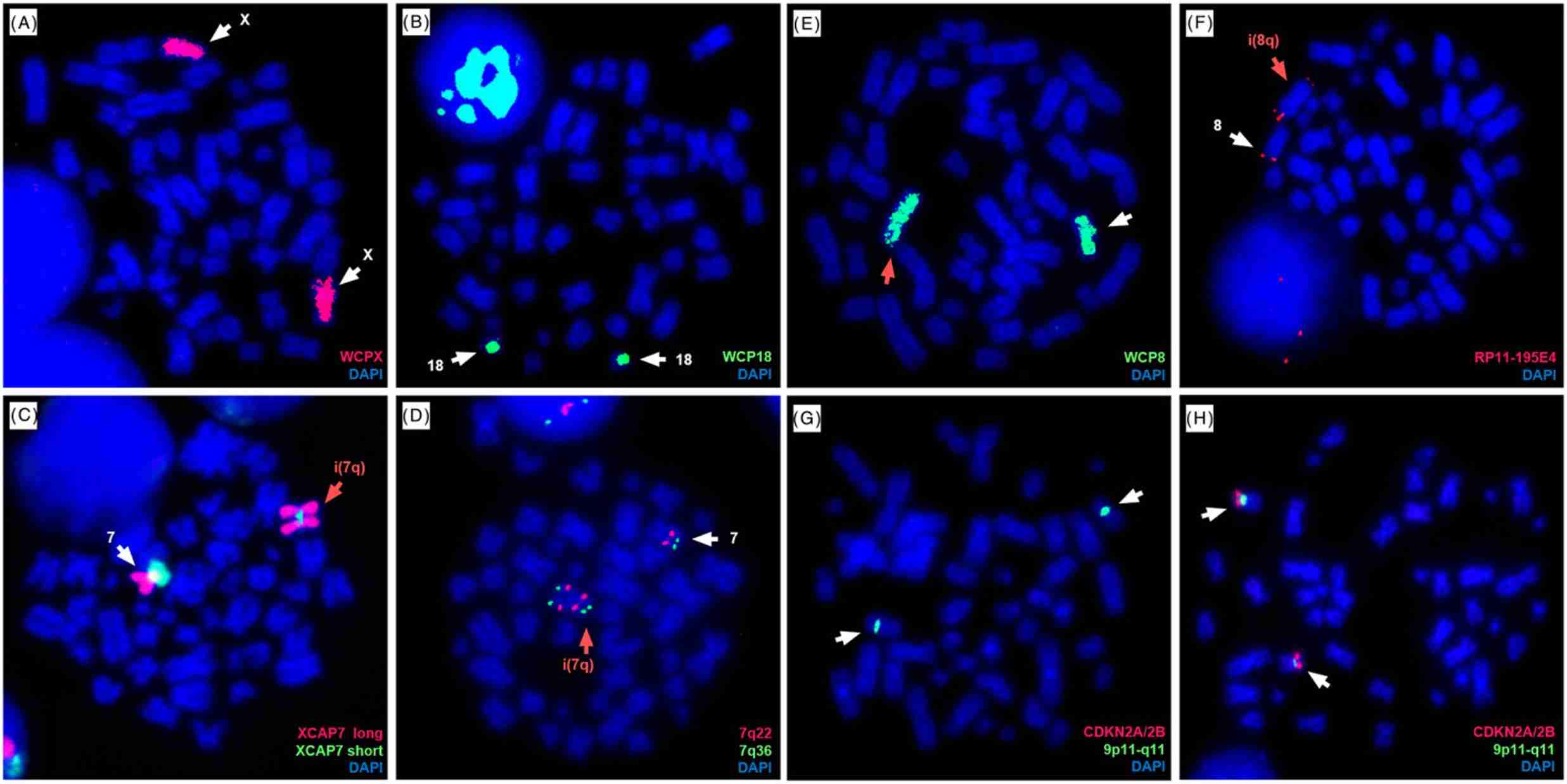 Fig. 2 Cytogenetic abnormalities investigated by FISH in the RS4;11 cell line. (Ragusa D, et al., 2019)