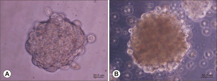Phase contrast images depict sarcospheres from human osteosarcoma cell lines, stained for ALP.
