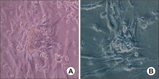 When sarcospheres were transferred from non-adherent culture to an adherent plate, the adhered spheres expanded into cancer cells.