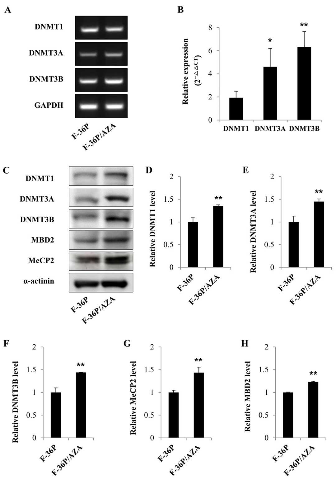 Gene expression and protein levels of DNMTs in F-36P and F-36P/AZA cells.