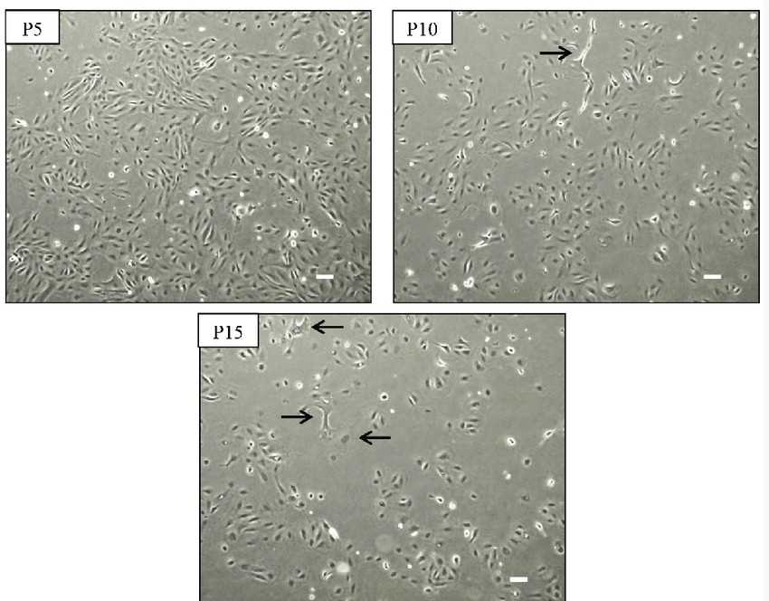 Serial-passage morphology of kidney fibroblasts.