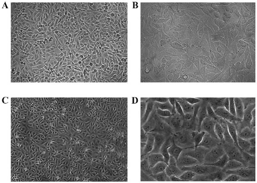 Effect of exposure time and concentration on PS-NP internalization in HUVECs.