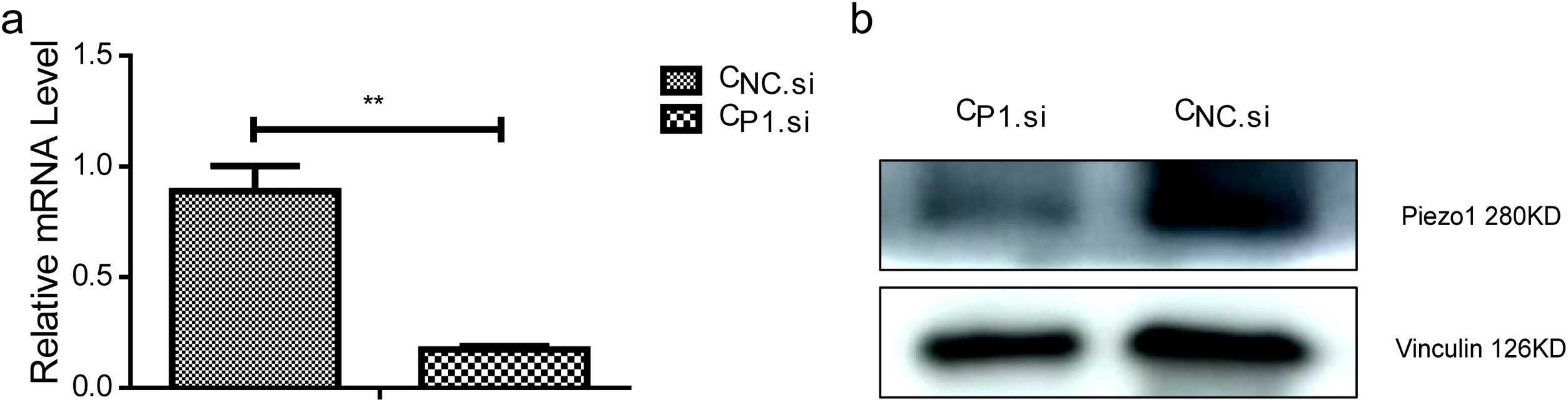 Calcium fluorescent images of CBlank cells subjected to ultrasound stimulation at 1 W and 0.2 W.