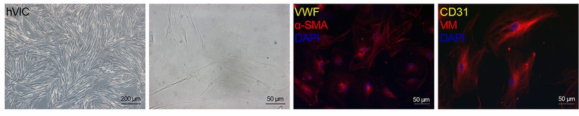Brightfield microscopy images and immunofluorescence staining of human valvular interstitial cells (hVICs) reveal positive staining for alpha-smooth muscle actin (α-SMA) and vimentin (VIM).
