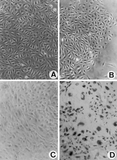 Immortalized HPMEC cultures generated through co-transfection with hTERT and SV40 large T antigen plasmids.