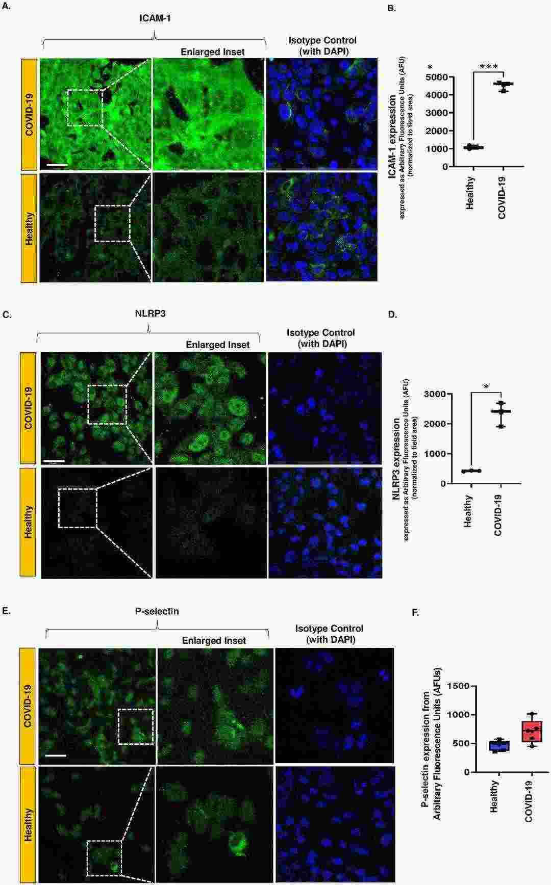 Inflammatory marker expression profiles in HPMVECs modeling COVID-19 pathogenesis in vitro.