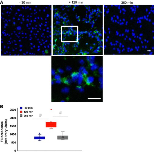 Serum-induced endothelial inflammation measured by intercellular adhesion molecule (ICAM) expression.