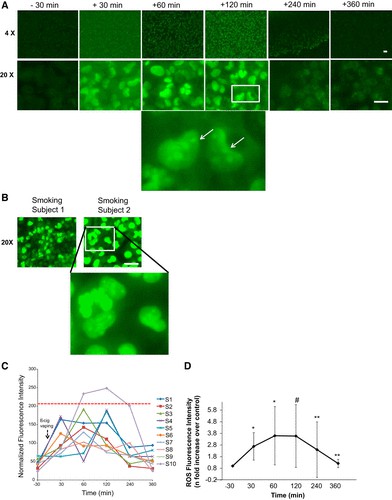 E-cigarette vaping serum-triggered endothelial activation in HPMVECs assessed by reactive oxygen species (ROS) production.