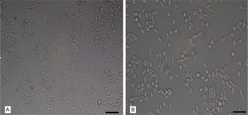 Immortalized HPMEC cultures generated through co-transfection with hTERT and SV40 large T antigen plasmids.