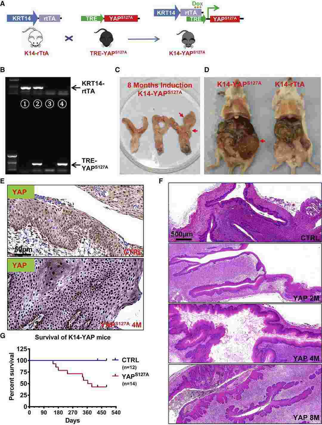 2.	Over-activation of YAP1 induces invasive cervical cancer in mice