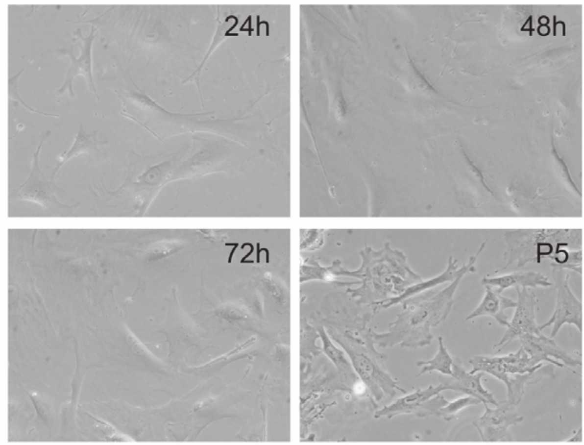 Morphological Characteristics of Primary Mouse Embryonic Fibroblasts (MEFs).
