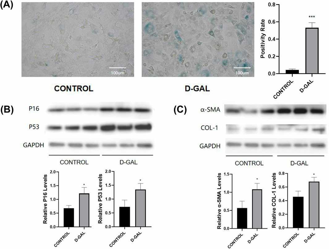 D-Gal-induced cellular senescence and fibrotic activation in fibroblasts.