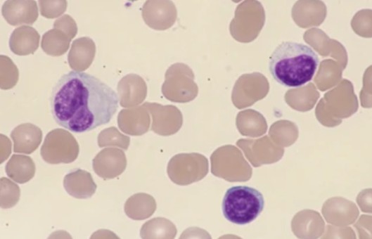 Peripheral Blood Mononuclear Cells