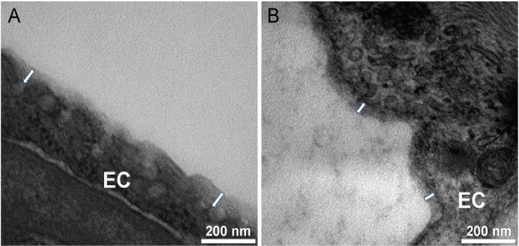 Glycocalyx-like structure assessment of lymphatic vessels.