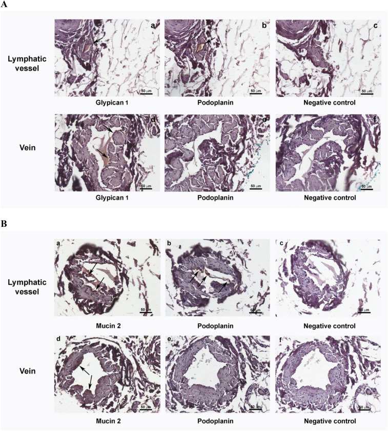 Immunohistochemistry showing lymphatic glycocalyx-like structure components.