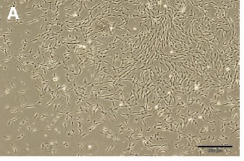 Dental pulp stem cells (DPSCs) in primary cultures.
