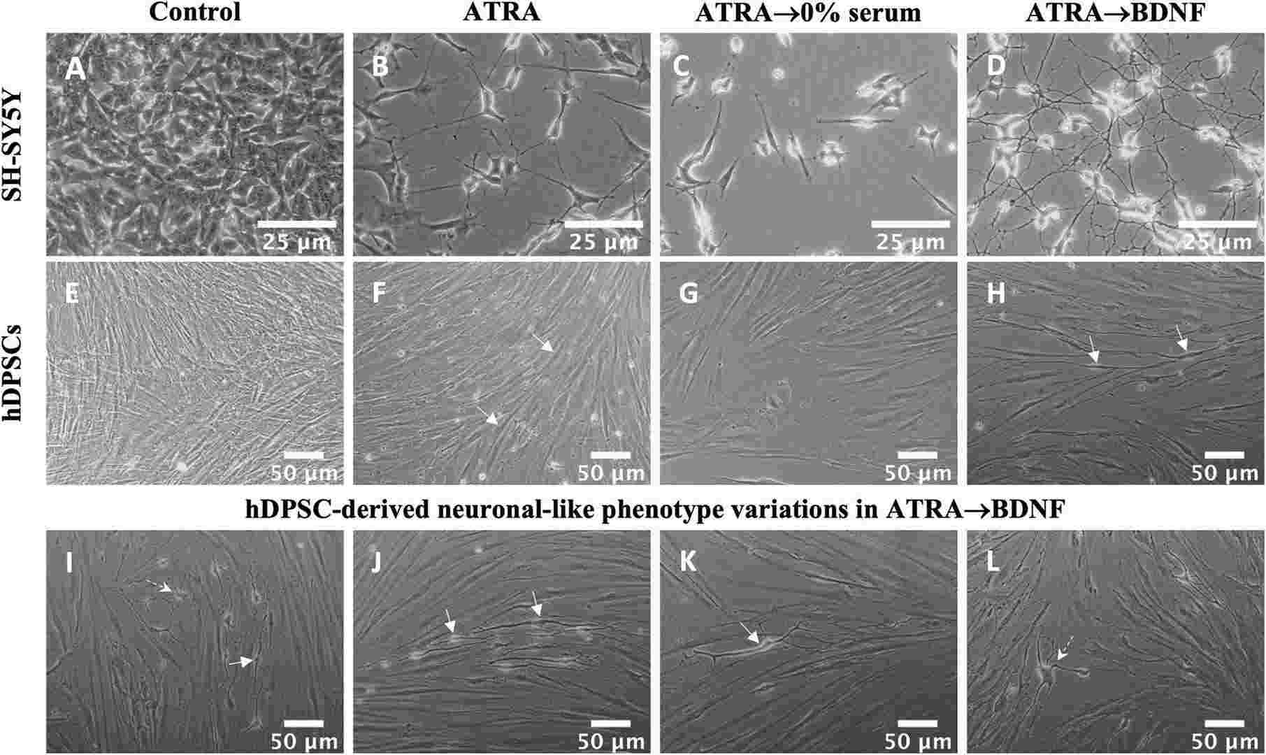 The neural differentiation observed in SH-SY5Y and hDPSC experimental groups was notable.