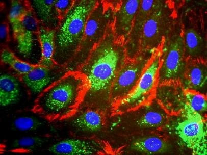 Phenotypic traits of human dermal microvascular endothelial cells.