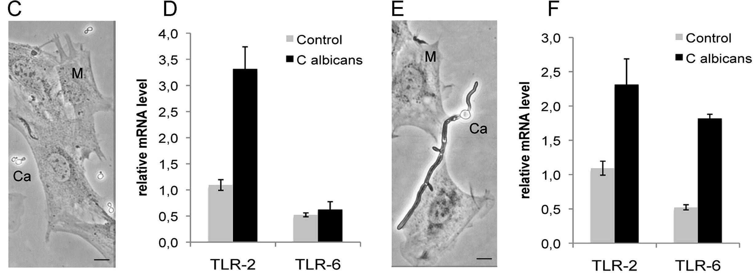 Expression of TLRs in MU-PH1 cell lines.