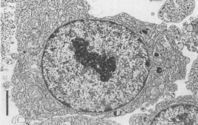 Electron micrographs of KMS-12-PE cells. (Ohtsuki T, et al., 1989)