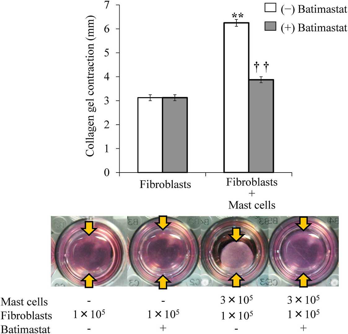 Impact of batimastat on collagen gel contraction in conjunctival fibroblast and mast cell co-cultures.