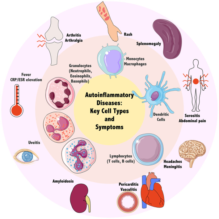 Fig. 1 Hallmarks of autoinflammation and major effector cell types.